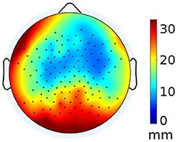 Effects of individualized brain anatomies and EEG electrode positions on inferred activity of the primary auditory cortex